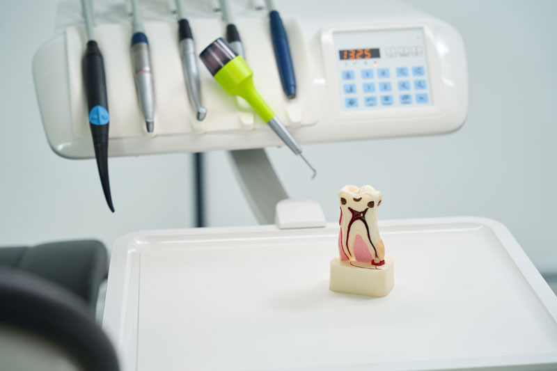 Root Canal Procedure